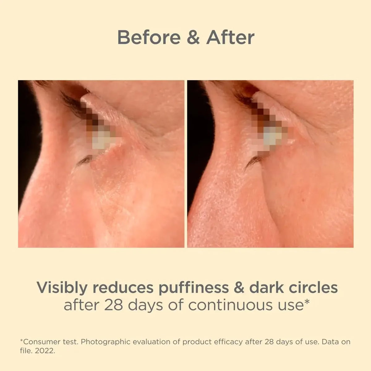 ISDIN K-Ox Eyes Cream 15ml